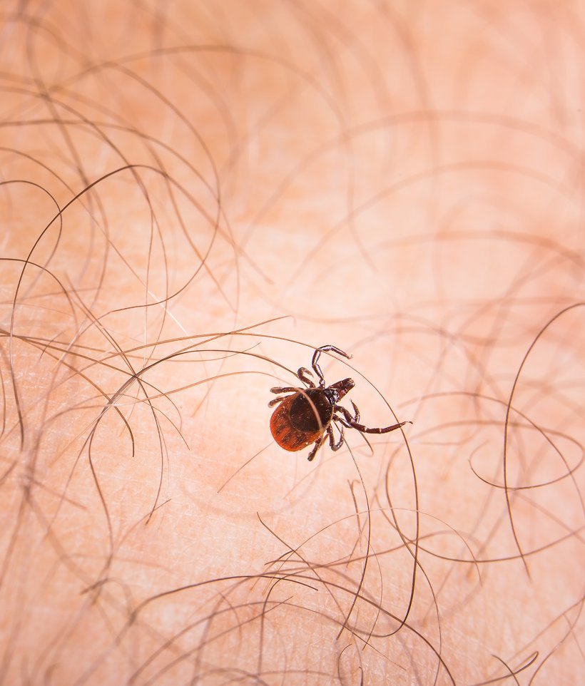 A tick on human skin among fine hairs